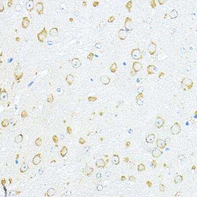 Immunohistochemistry-Paraffin: RPL10A Antibody - BSA Free [NBP2-93591]