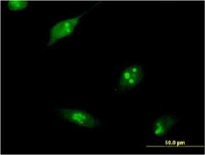 Immunocytochemistry/ Immunofluorescence: RPL10L Antibody (1E9) [H00140801-M01]