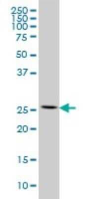 Western Blot: RPL13 Antibody (3F6) [H00006137-M01]