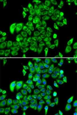 Immunocytochemistry/ Immunofluorescence: RPL13 Antibody - BSA Free [NBP2-94110]