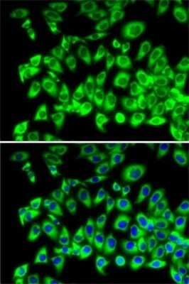Immunocytochemistry/ Immunofluorescence: RPL13 Antibody - BSA Free [NBP2-94875]