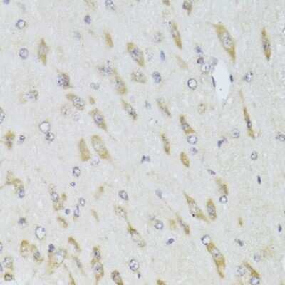 Immunohistochemistry-Paraffin: RPL13 Antibody - BSA Free [NBP2-94110]