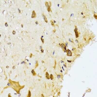 Immunohistochemistry-Paraffin: RPL13 Antibody - BSA Free [NBP2-94110]