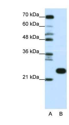 Western Blot: RPL13 Antibody [NBP1-57476]