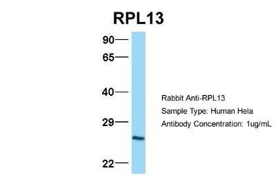 Western Blot: RPL13 Antibody [NBP1-57476]