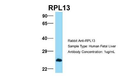 Western Blot: RPL13 Antibody [NBP1-57476]