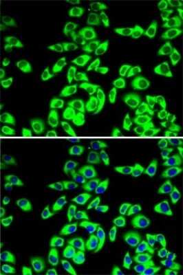 Immunocytochemistry/ Immunofluorescence: RPL14 Antibody - BSA Free [NBP2-94115]