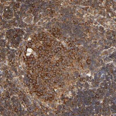 Immunohistochemistry-Paraffin: RPL14 Antibody [NBP1-85385]
