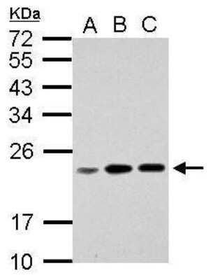 Western Blot: RPL17P7 Antibody [NBP2-42919]