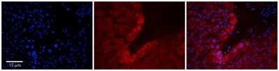 Immunohistochemistry-Paraffin: RPL18 Antibody [NBP2-88185]