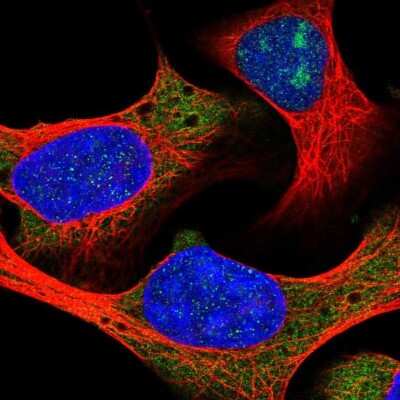 Immunocytochemistry/ Immunofluorescence: RPL18A Antibody [NBP2-30708]
