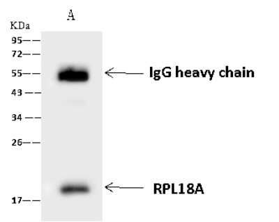 Immunoprecipitation: RPL18A Antibody [NBP2-97781]