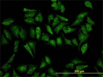 Immunocytochemistry/ Immunofluorescence: RPL19 Antibody (3H4) [H00006143-M01]