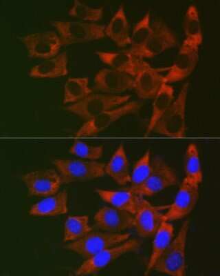 Immunocytochemistry/ Immunofluorescence: RPL19 Antibody - Azide and BSA Free [NBP3-16045]
