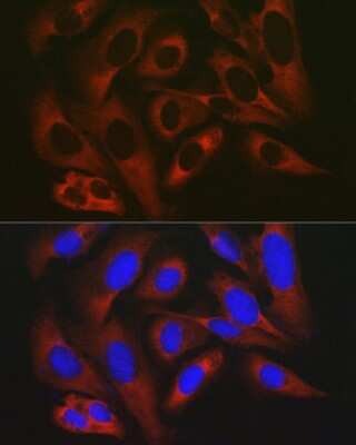 Immunocytochemistry/ Immunofluorescence: RPL19 Antibody - Azide and BSA Free [NBP3-16045]
