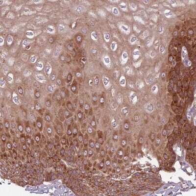 Immunohistochemistry-Paraffin: RPL21 Antibody [NBP2-13252]