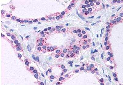 Immunohistochemistry-Paraffin: RPL22 Antibody [NBP1-06069]