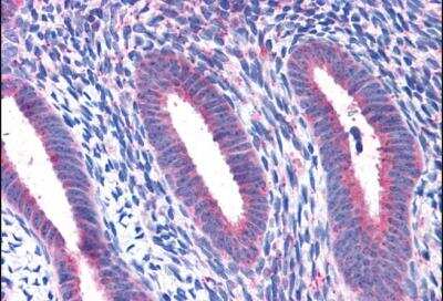 Immunohistochemistry-Paraffin: RPL22 Antibody [NBP1-06069]