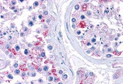 Immunohistochemistry-Paraffin: RPL22 Antibody [NBP1-06069]