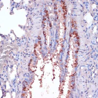 Immunohistochemistry-Paraffin: RPL22 Antibody - Azide and BSA Free [NBP2-93082]