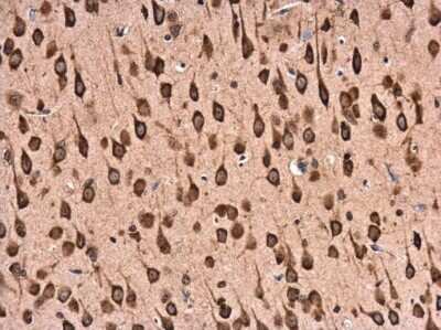 Immunohistochemistry-Paraffin: RPL22 Antibody [NBP3-12976]
