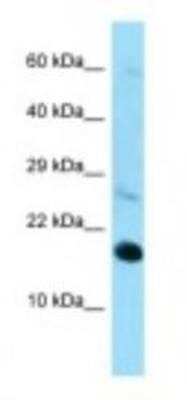 Western Blot: RPL22 Antibody [NBP1-98446]