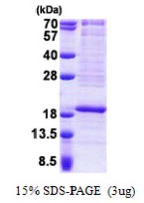 SDS-PAGE: Recombinant Human RPL22 His Protein [NBP2-23419]