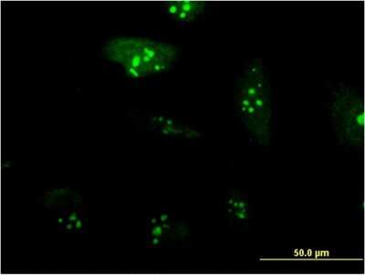 Immunocytochemistry/ Immunofluorescence: RPL23A Antibody (3E11) [H00006147-M10]