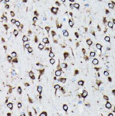 Immunohistochemistry-Paraffin: RPL23A Antibody - BSA Free [NBP2-93160]