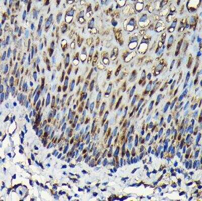 Immunohistochemistry-Paraffin: RPL23A Antibody - BSA Free [NBP2-93160]