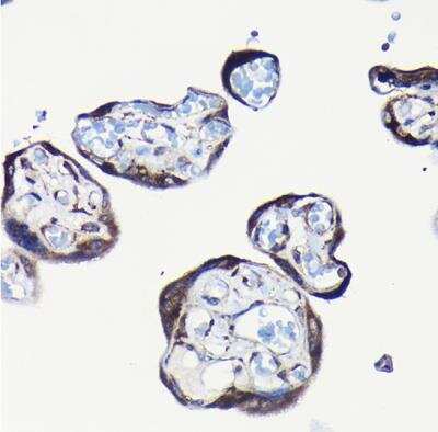 Immunohistochemistry-Paraffin: RPL23A Antibody - BSA Free [NBP2-93160]