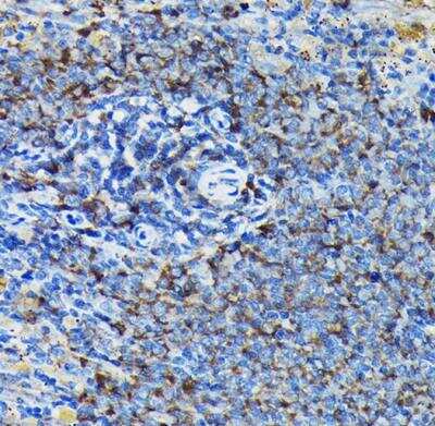 Immunohistochemistry-Paraffin: RPL23A Antibody - BSA Free [NBP2-93160]