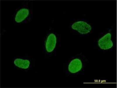 Immunocytochemistry/ Immunofluorescence: RPL24/RLP24 Antibody (2A10-1E5) [H00051187-M01]