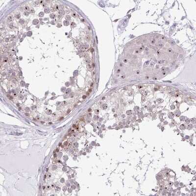 Immunohistochemistry-Paraffin: RPL24/RLP24 Antibody [NBP2-38971]