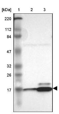Western Blot: RPL27 Antibody [NBP1-82856]