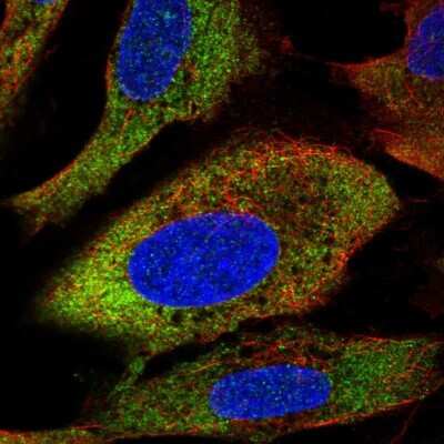 Immunocytochemistry/ Immunofluorescence: RPL27A Antibody [NBP2-38025]