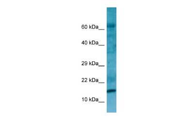 Western Blot: RPL27A Antibody [NBP2-85657]