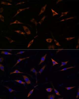 Immunocytochemistry/ Immunofluorescence: RPL28 Antibody - Azide and BSA Free [NBP2-93881]