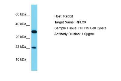 Western Blot: RPL28 Antibody [NBP2-83467]