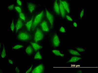 Immunocytochemistry/ Immunofluorescence: RPL29 Antibody [H00006159-B02P]