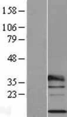 Western Blot: RPL29 Overexpression Lysate [NBP2-04184]