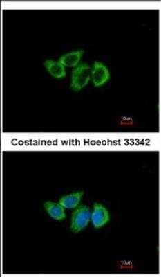 Immunocytochemistry/ Immunofluorescence: RPL3 Antibody [NBP2-20213]