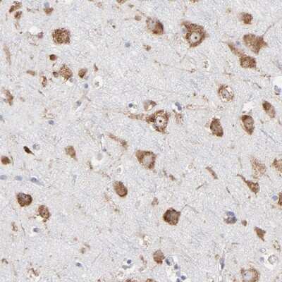 Immunohistochemistry-Paraffin: RPL3 Antibody [NBP1-81332]