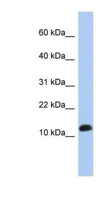 Western Blot: RPL30 Antibody [NBP1-53069]