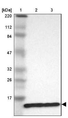 Western Blot: RPL30 Antibody [NBP1-82855]
