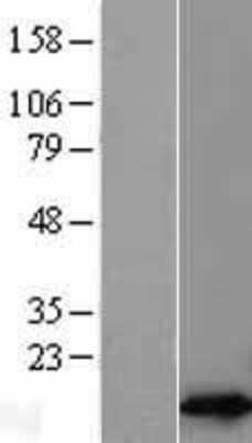 Western Blot: RPL30 Overexpression Lysate [NBL1-15524]