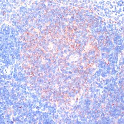 Immunohistochemistry-Paraffin: RPL31 Antibody - Azide and BSA Free [NBP2-94135]