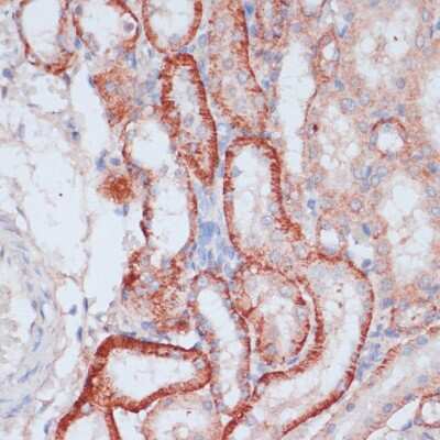 Immunohistochemistry-Paraffin: RPL31 Antibody - Azide and BSA Free [NBP2-94135]