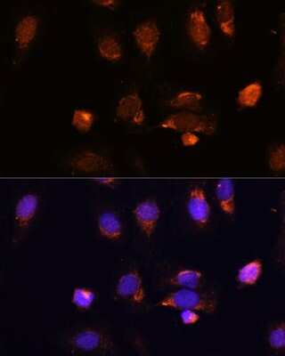 Immunocytochemistry/ Immunofluorescence: RPL34 Antibody - Azide and BSA Free [NBP2-93028]