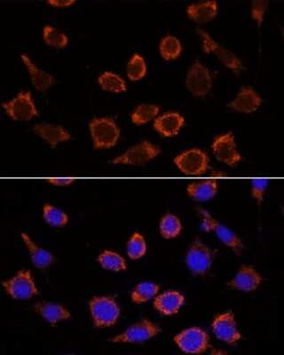 Immunocytochemistry/ Immunofluorescence: RPL35 Antibody - Azide and BSA Free [NBP3-15546]